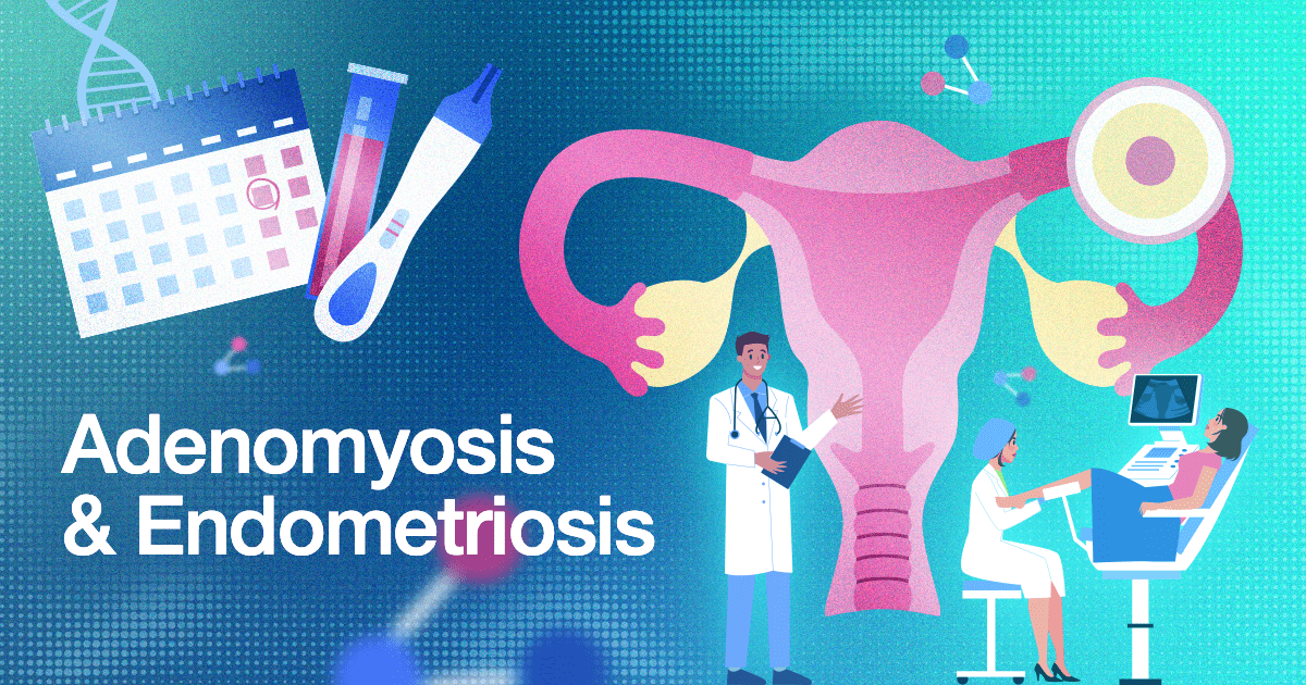 Adenomyosis And Endometriosis Esco Medical